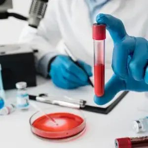 Diplomado Internacional en Hematología para Médicos